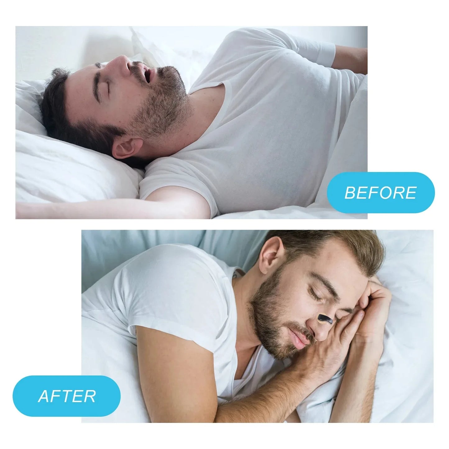 👃✨ Magnetic Nose Strips – Καλύτερη Αναπνοή & Ήσυχος Ύπνος! ✨😴 Anti-Snoring Nose Clip | Breathing Dilator | Sports & Sleep Aid