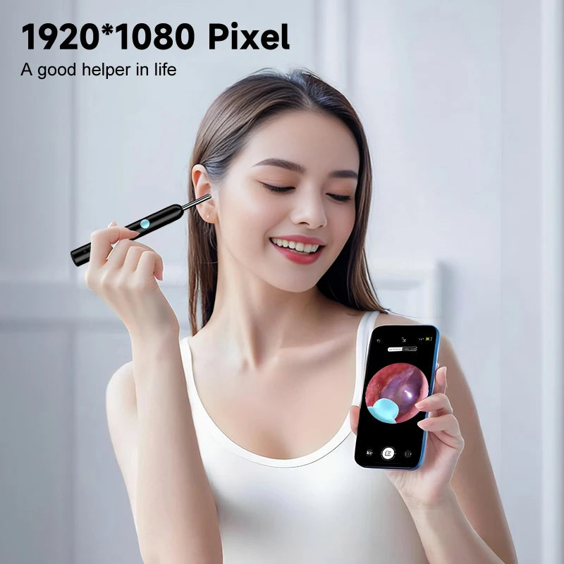 🔥👂 Smart Visual Ear Camera HD1080P – Καθαρά Αυτιά με Τεχνολογία! 📱✨