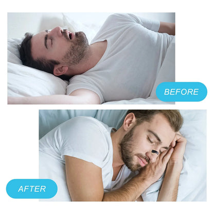 😴👃 Magnetic Nasal Dilator – Λύση για Ροχαλητό & Καλύτερη Αναπνοή! 👃😴 Anti-Snoring Strips | Boost Oxygen Intake | Sleep & Sports Breathing Aid