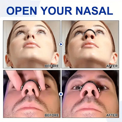 😴👃 Sport Magnetic Nasal Dilator – Ελεύθερη Αναπνοή & Ήσυχος Ύπνος! 👃😴 Anti-Snoring Kit | Breathing Strips + Magnetic Nose Clips | Sleep & Sports Aid